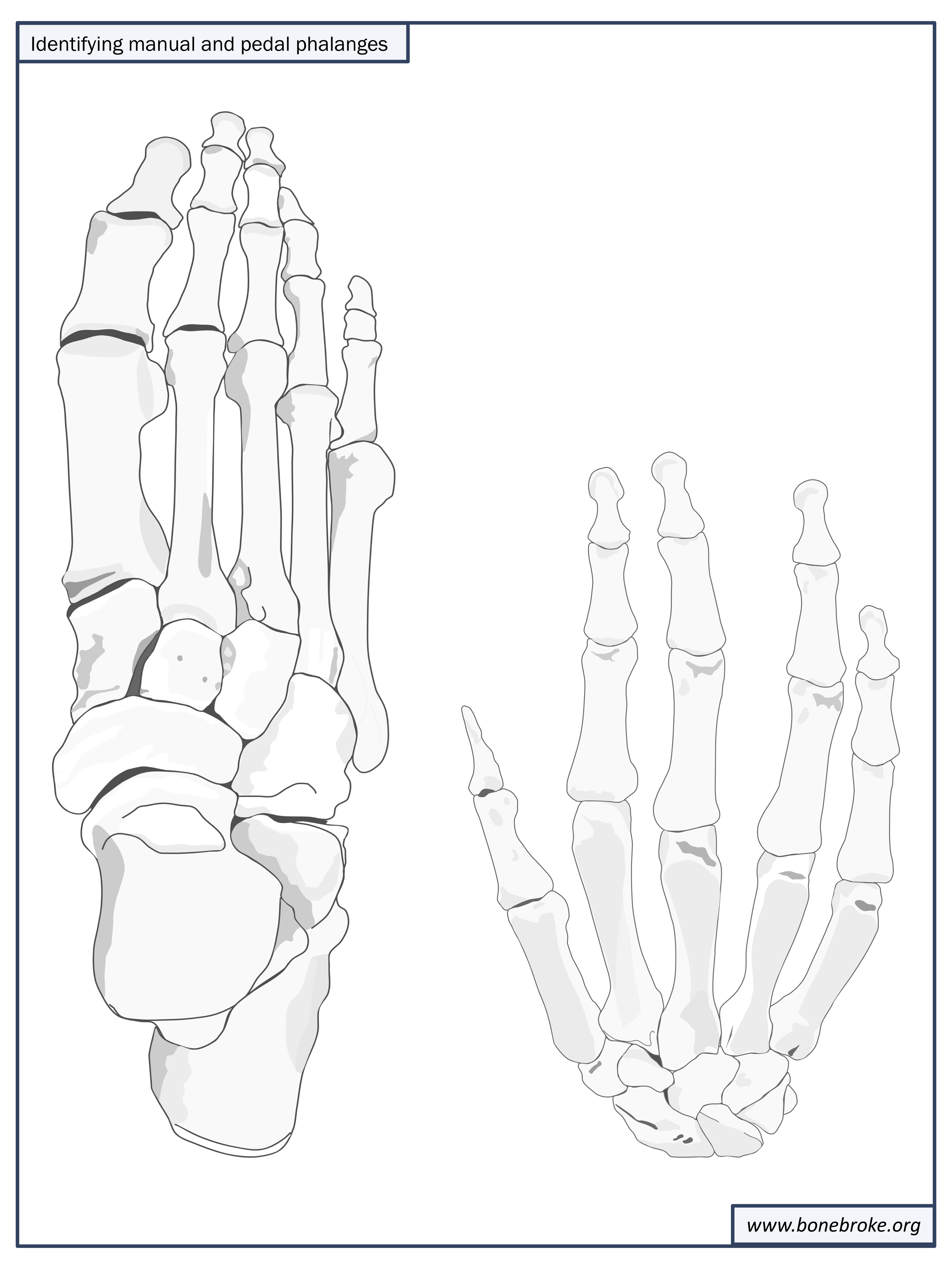 Gotta hand it to you: identifying manual and pedal phalanges | Bone Broke